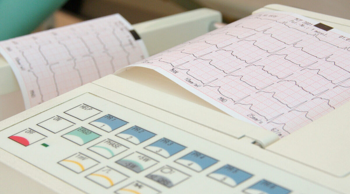 Langzeit EKG Protrain Fitness Emmelshausen Dein Experte für